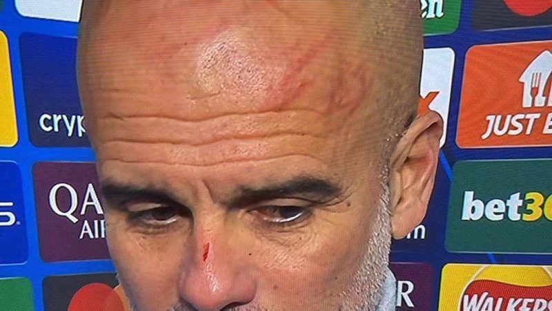 (VIDEO) ¡Enloqueció! ¡Guardiola se reventó la cabeza porque su equipo no pudo ganar otra vez!