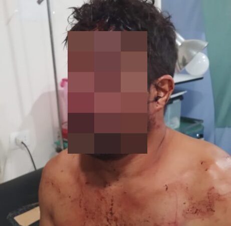 Hombre fue atacado con machete por sus cuñados
