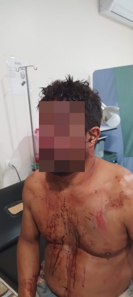 Hombre fue atacado con machete por sus cuñados