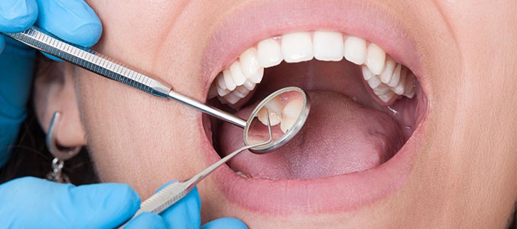 Caries Cero en las Escuelas»: Salud Bucodental como aliada de Hambre Cero