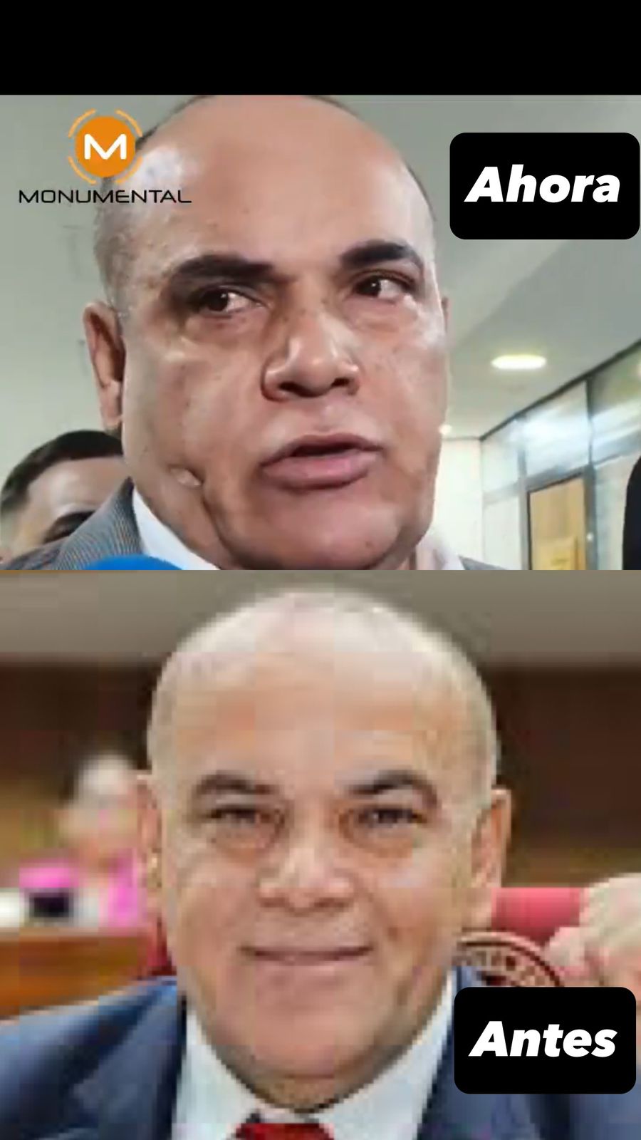 ”¡Bachi Núñez sorprende con un rostro renovado!  ¿El poder también se lleva en la cara?”