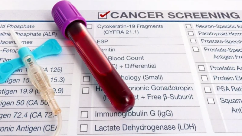 Oncólogo cuestiona lanzamiento de protocolo de cáncer: “no están dadas las condiciones”