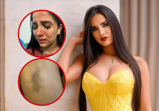 Joven modelo denuncia a funcionario judicial por presunta agresión física y verbal