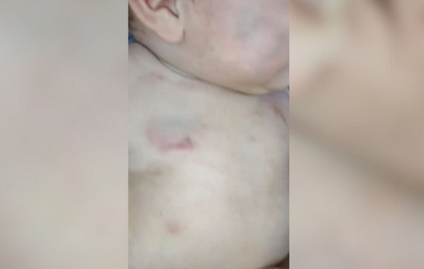 Bebé internado tras presunta agresión en Minga Guazú