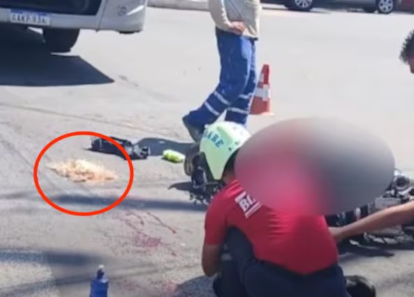 Pasajera de motocicleta sufre desprendimiento de cuero cabelludo en accidente