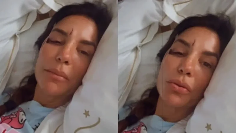 Ivete Sangalo sufrió un accidente doméstico