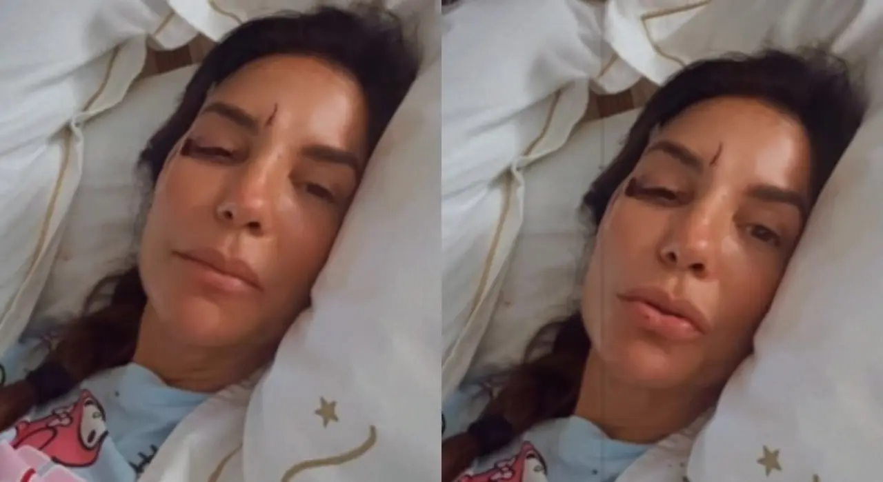 Ivete Sangalo sufrió un accidente doméstico